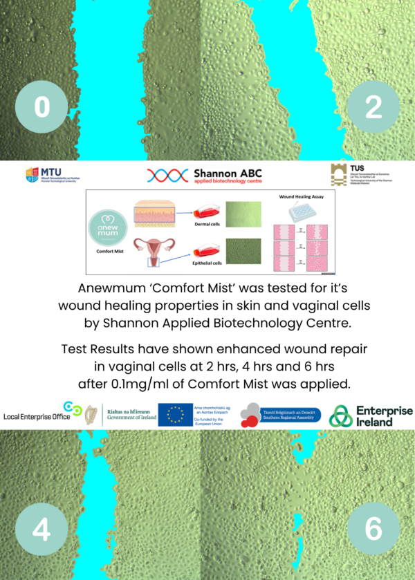 Anewmum Comfort Mist - Pre & Post Birth Multipurpose Spray - Image 2