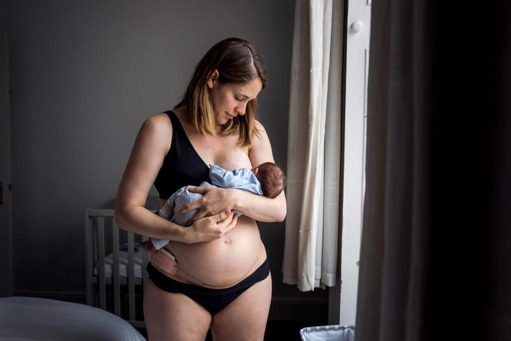 learn to love your postpartum lines by Neely Ker-Fox