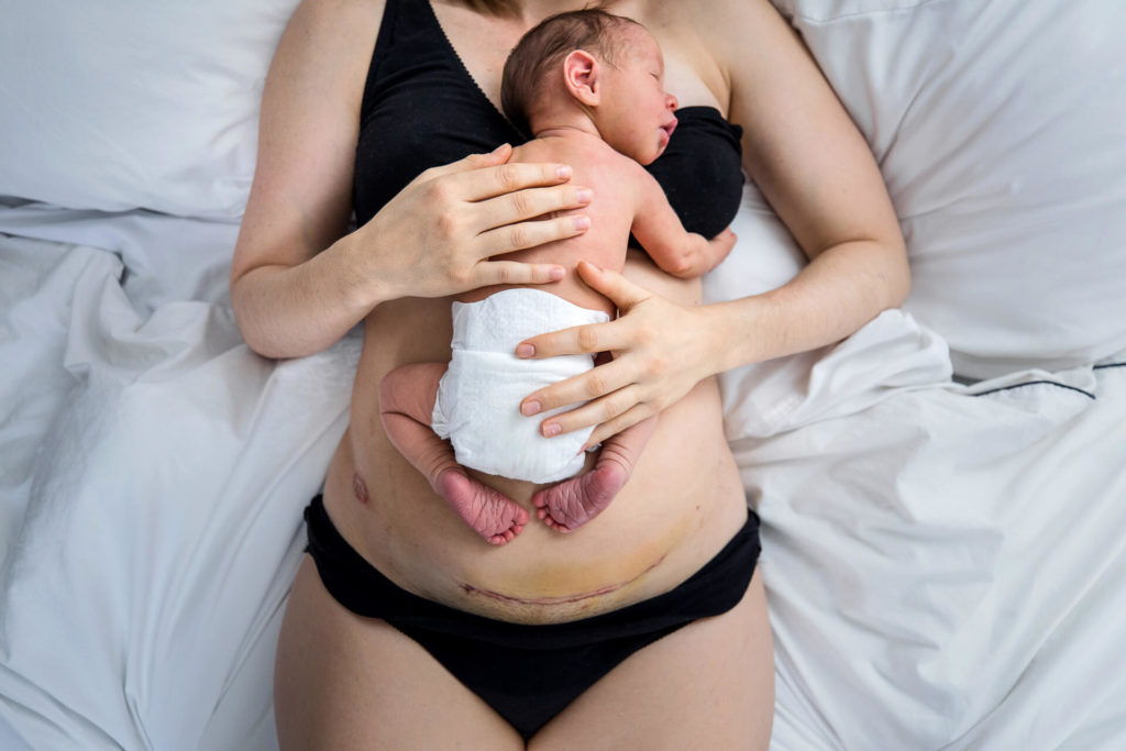 learn to love your postpartum lines by Neely Ker-Fox